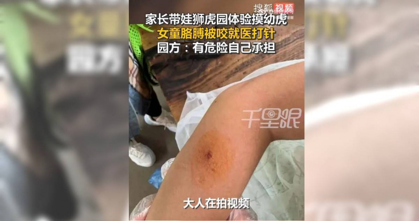 遼寧一名女童在狮虎園體驗『近距離撫摸幼虎』活動時遭咬傷，引發安全疑慮。（圖／翻攝自大江網）