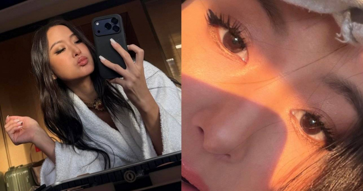 孫芸芸超近自拍全臉零皺紋掀熱議：47歲活出27歲美貌