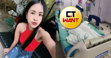 亂吃止痛藥!雪白嫩妹「全身一片焦黑」…皮膚層層剝落潰爛