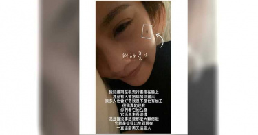傳「加工」臉上黑痣 楊丞琳PO文解釋「誰想要這麼大!」