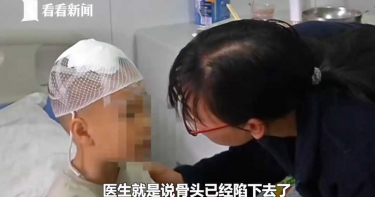 5歲女童遭「天降躺椅」砸中爆頭!術後醫嘆:回不去了