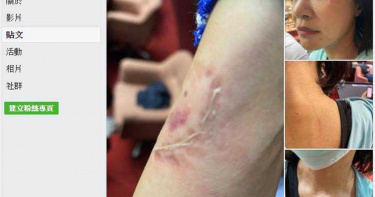立院藍綠衝突涉嫌咬人不放 林楚茵提告呂玉玲傷害與強制罪