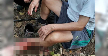 無妄之災!民眾登高雄北柴山 疑遭軍方打靶流彈一擊貫穿