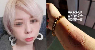大逆轉!前空姐甩巴掌踹打婆婆「辣油抹自己」 親友痛訴:一切都是她計畫好的