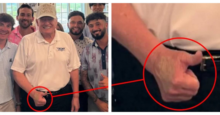 川普於弗吉尼亞州川普高爾夫俱樂部現身，左手背明顯瘀青曝光。（圖／翻攝自X，@patriottakes）