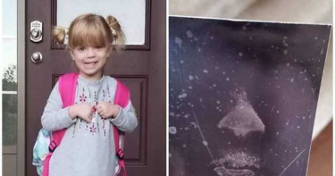 4歲女童高燒導致癲癇猝死 意外留下玻璃吻痕 家人求「複製保存」