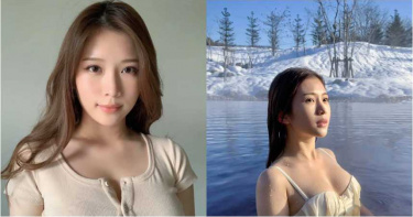 雞排妹自爆「乳暈雷射」 網爆:真的粉紅色