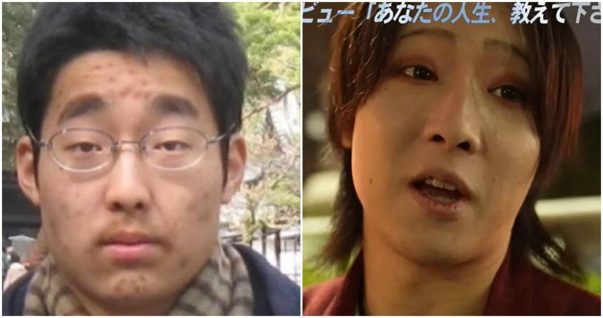 日屋仁希從被欺負的內向男變成花美男。（圖／翻攝YT頻道街録ch〜あなたの人生、教えて下さい〜，下同）