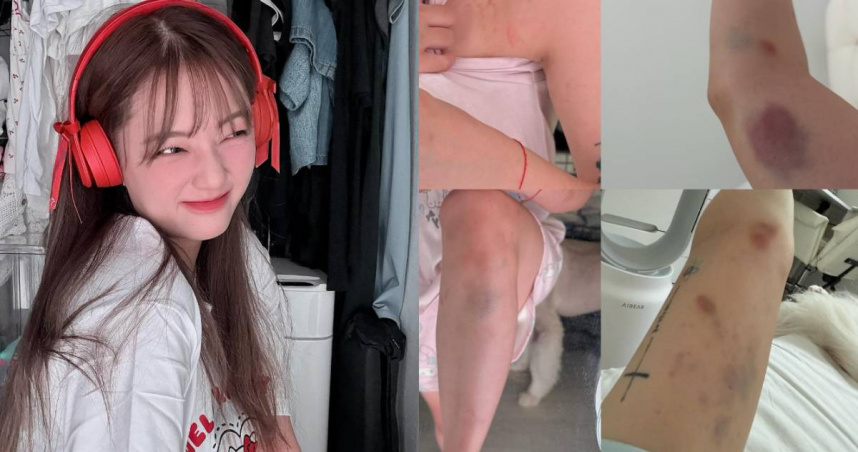 劉力穎自曝拒絕與韓國男生回家被痛毆。（圖／翻攝自Instagram@liying0731）