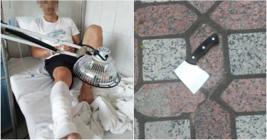 鋒利菜刀從天而降! 無辜男被「斷腳筋」:差一步頭就沒了