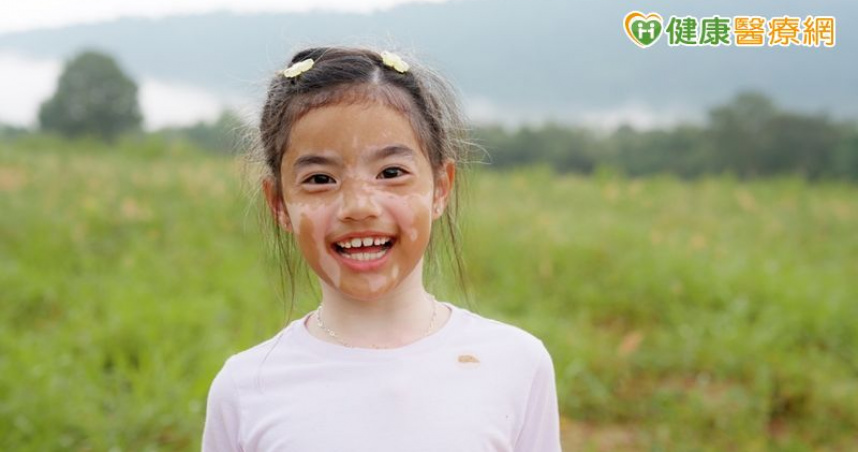 女童患白斑症飽受異樣眼光　「黑色素移植手術」助重獲自信