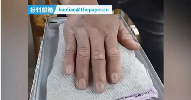 「欲練神功必下苦功」 男練鐵砂掌每日鐵槌敲手1000下:我從小熱愛武術