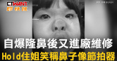 圖說-自爆隆鼻後又進廠維修　Hold住姐笑稱鼻子像節拍器