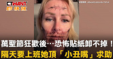 圖說-萬聖節狂歡後⋯恐怖貼紙卸不掉！　隔天要上班她頂「小丑嘴」求助