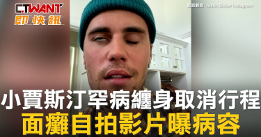 圖說-小賈斯汀罕病纏身取消行程　面癱自拍影片曝病容