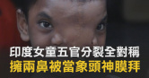 圖說-印度女童「五官分裂」全對稱　擁兩鼻被當「象頭神」膜拜