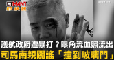 圖說-護航政府遭暴打？眼角流血照流出　司馬南親闢謠「撞到玻璃門」