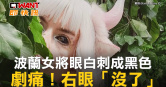 圖說-波蘭女將眼白刺成黑色　劇痛！右眼「沒了」
