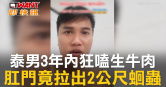 圖說-泰男3年內狂嗑生牛肉  肛門竟拉出2公尺蛔蟲